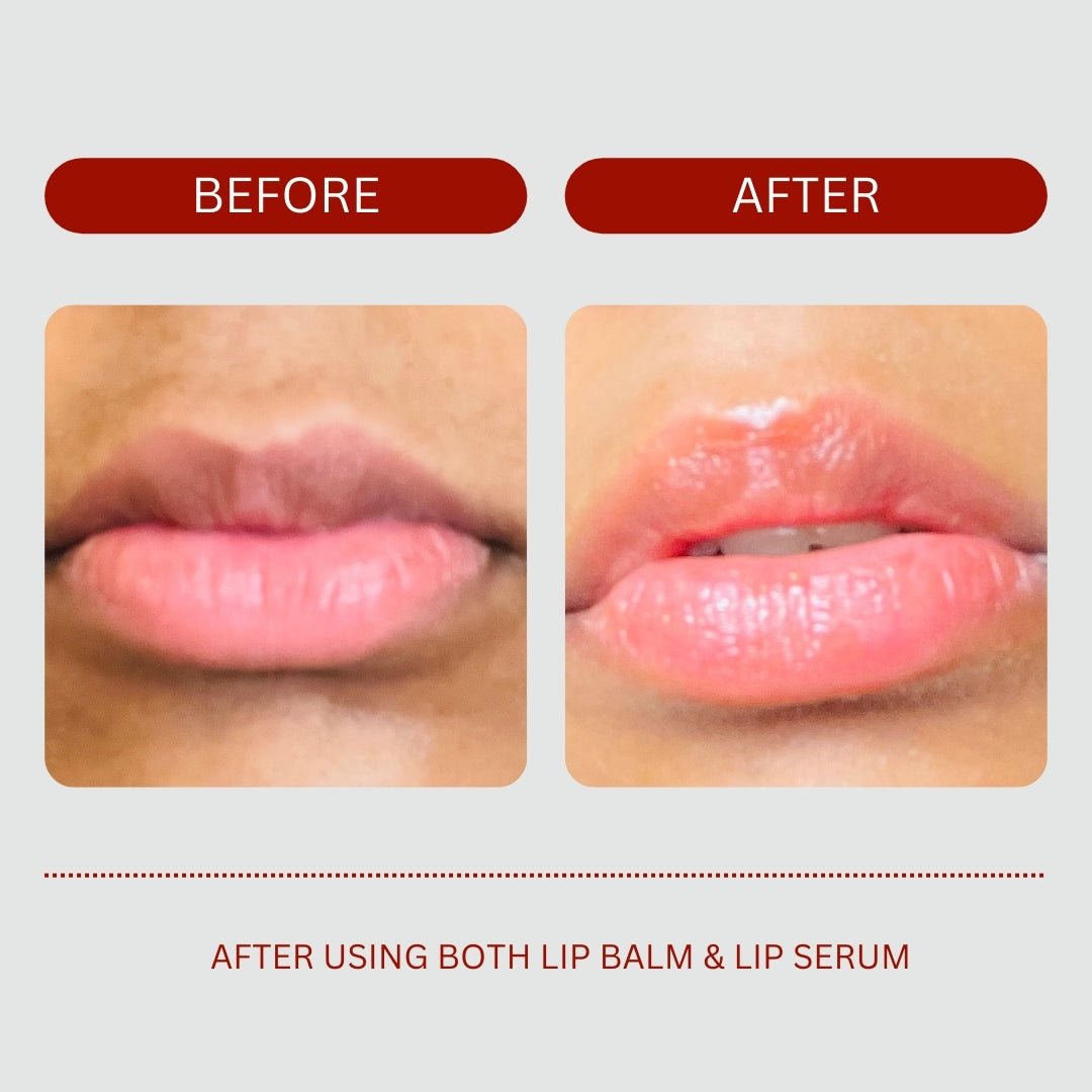 Beta Carotene - Lip Brightening Serum