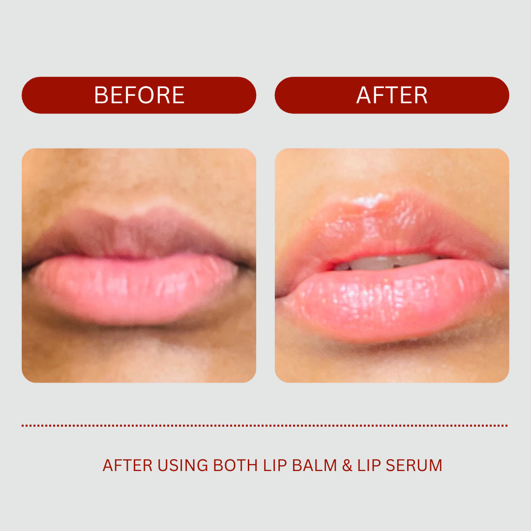 The image shows a before and after comparison of a person's lips. The before image on the left shows dry, chapped lips. The after image on the right shows the same lips looking much smoother, plumper and hydrated after using both a lip balm and lip serum according to the text below the images. The background is light gray, and the before/after labels are in red rectangular boxes.